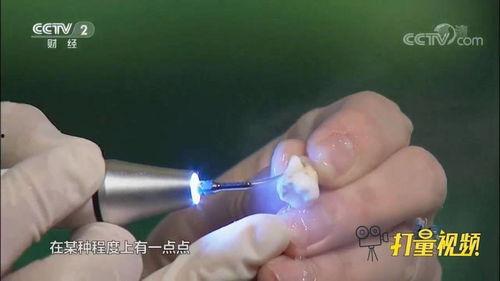 洗牙视频大全